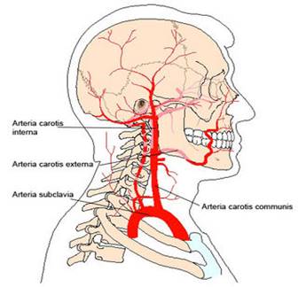 jobb oldali nyaki ütőér fájdalom a könyökízület artrózisa 1 fokos kezelés