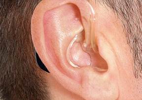A hallásromlás nem csak az időseket érinti - egyre több fiatal küzd rosszabb hallással