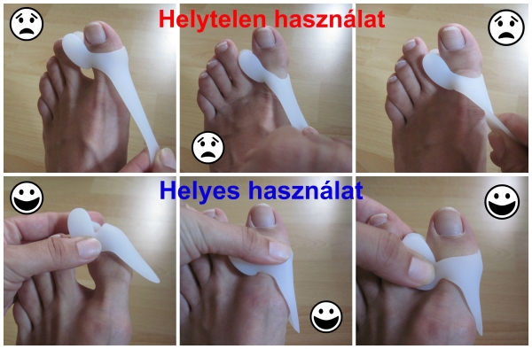 a középső lábujj ízületi kezelése)