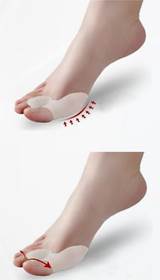 hogyan lehet enyhíteni a lábujj ízületgyulladását)