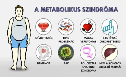 Metabolikus szindróma - 4 tünet együttes kezelése